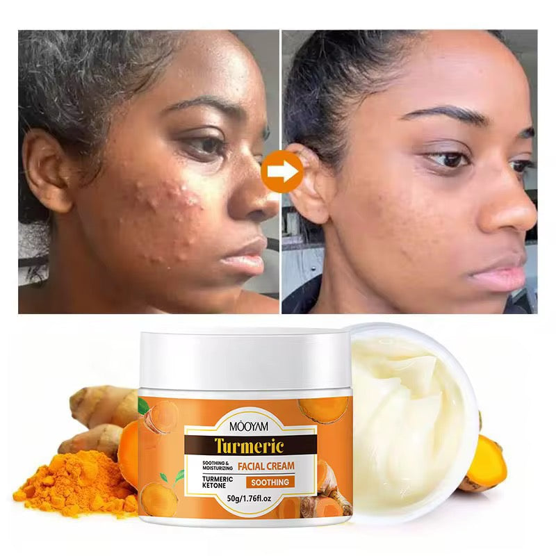 Créme anti bouton pour visage