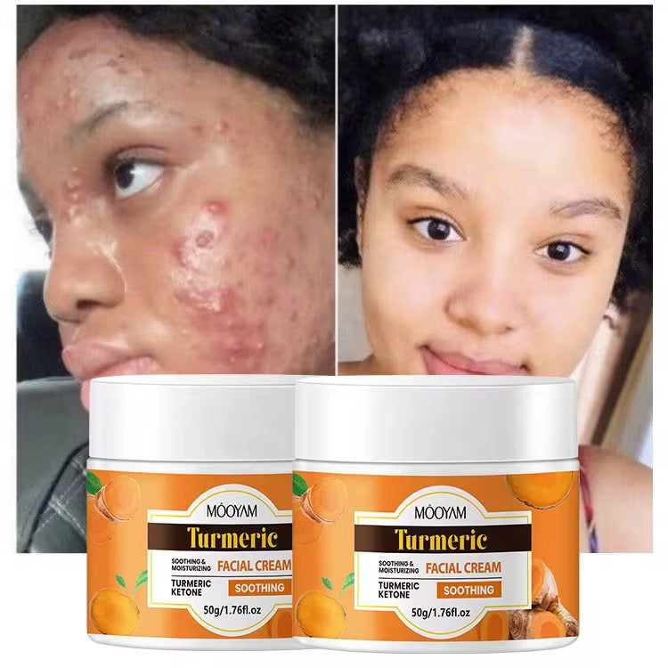 Créme anti bouton pour visage